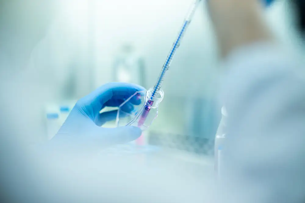Effective Stem Cell Therapy at Bioinfinity Clinic in Frisco TX